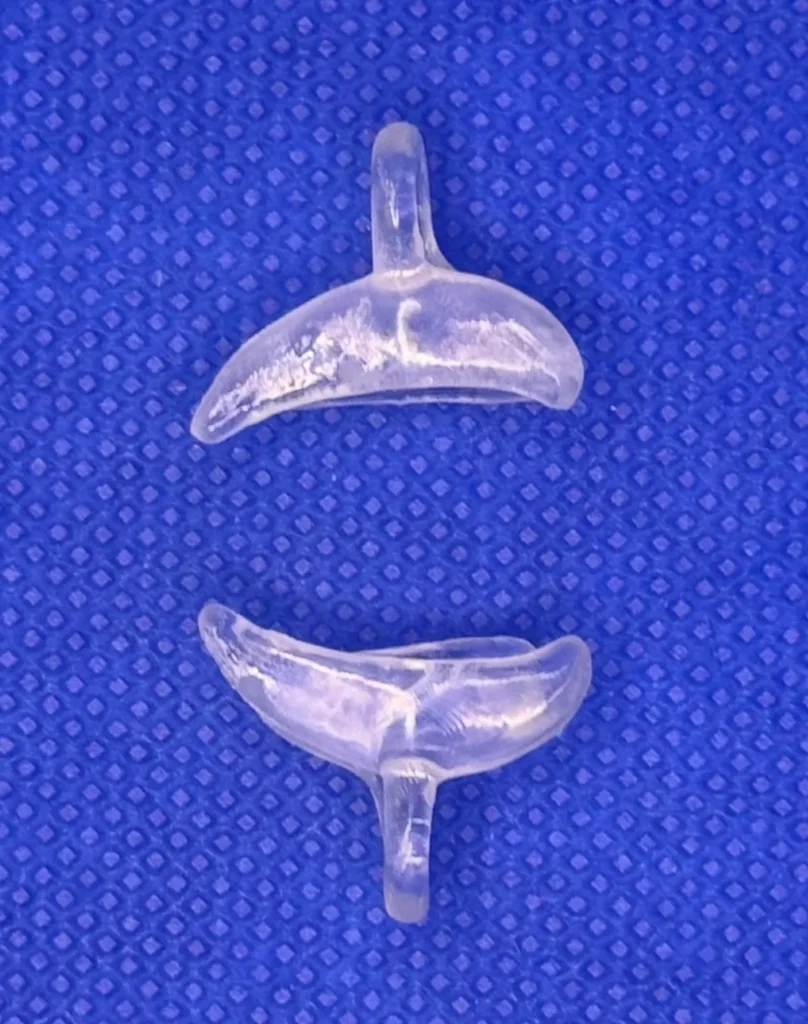 Two transparent HelixForm ear molding clips